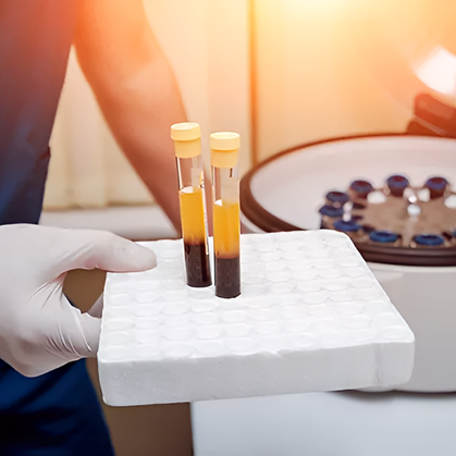 Osocze bogatopłytkowe w ortopedii